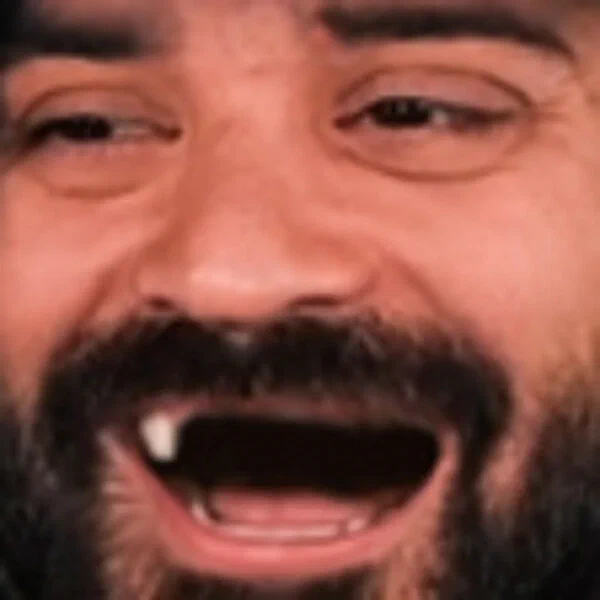 Roshtein laughing with his mouth wide open, close-up